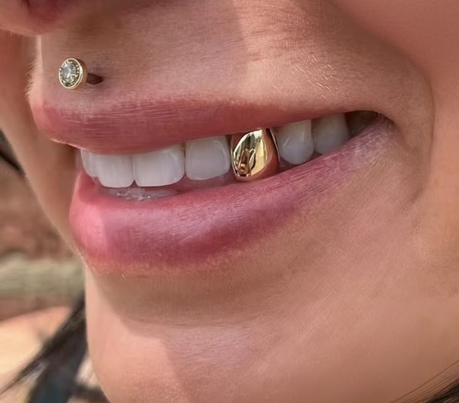 Grillz or 1 dent